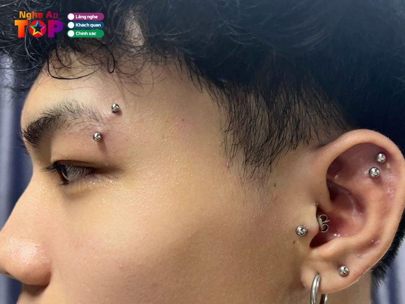 Tiem-xo-khuyen-tp-vinh-ngheantoplist