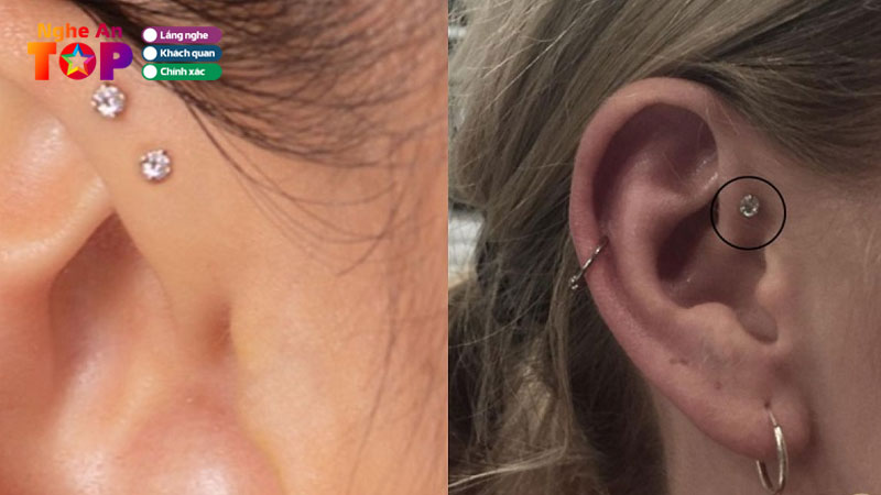 top-4-dia-chi-xo-khuyen-o-nghe-an-an-toan-khong-dau-ngheantoplist