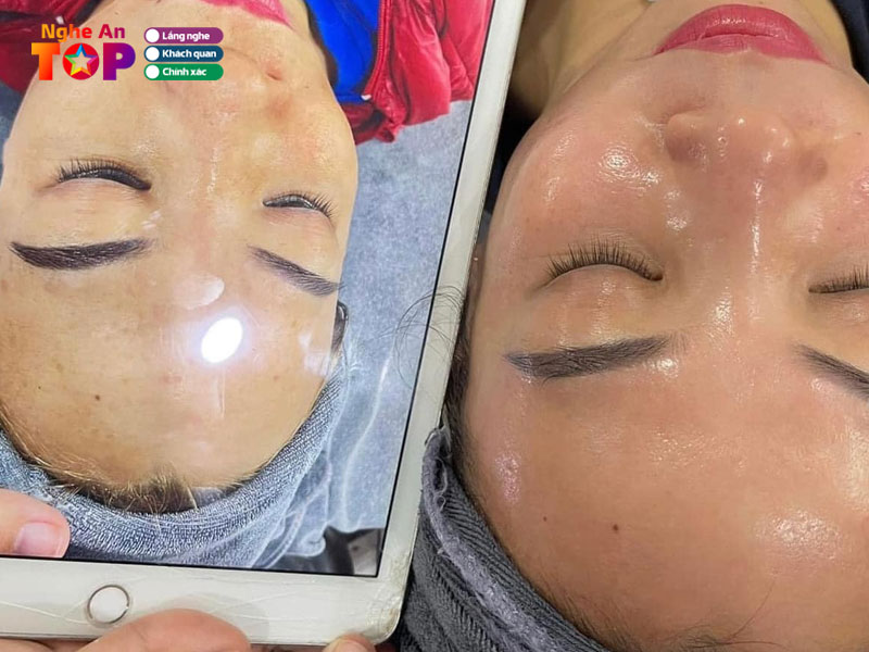 thuy-spa-ngheantoplist