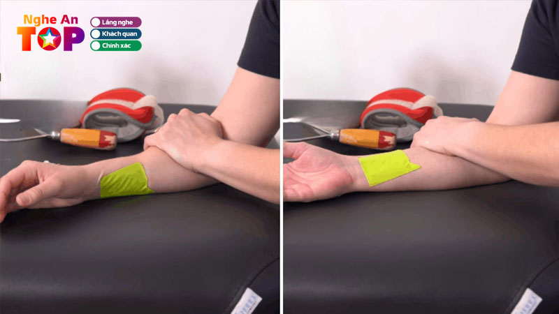 Bai-tap-khop-khuyu-tay-ngheantoplist