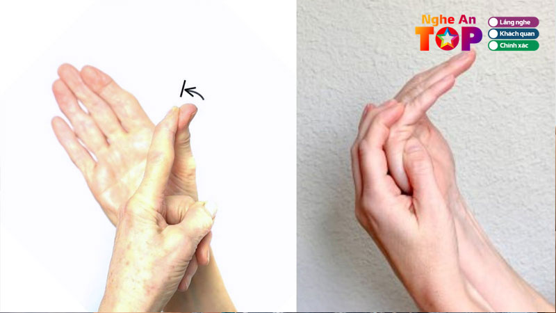 Cac-bai-tap-cho-nguoi-tai-bien-ngheantoplist