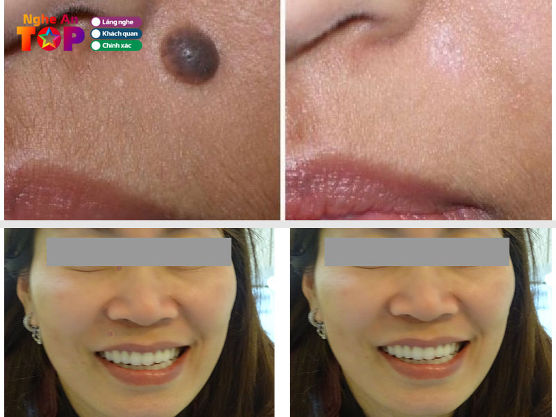 Benh-vien-thai-thuong-hoang-ngheantoplist