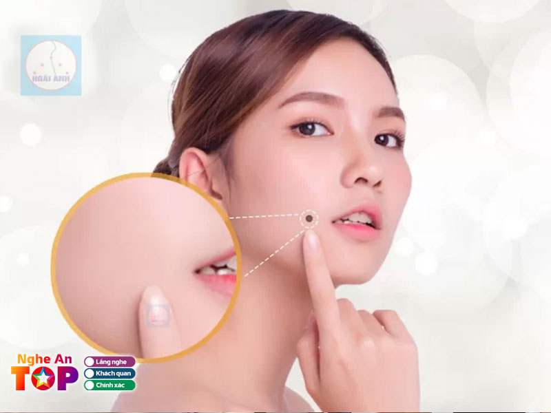 Tham-my-vien-hoai-anh-ngheantoplist