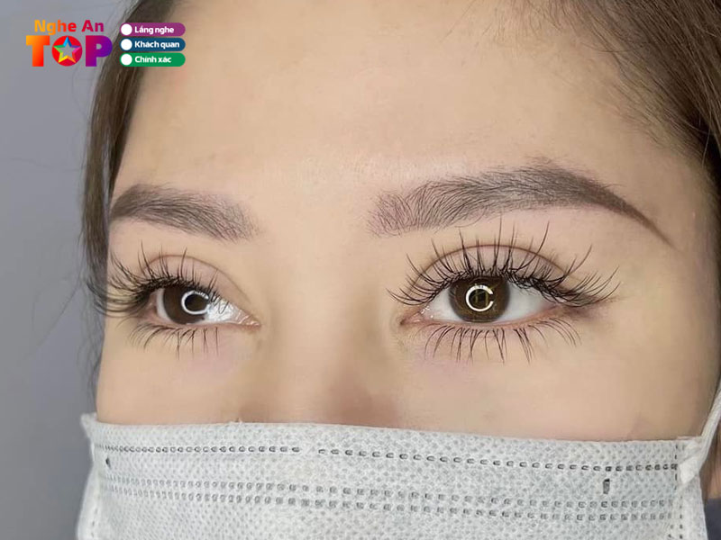 Ngoc-bich-noi-mi-ngheantoplist