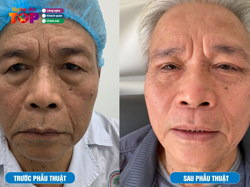 Benh-vien-da-khoa-thanh-pho-vinh-ngheantoplist