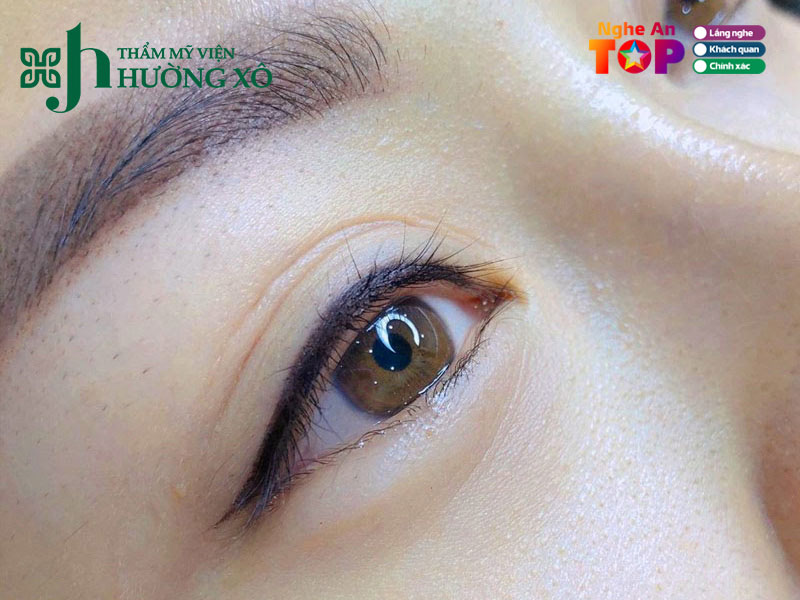 Tham-my-vien-huong-xo-ngheantoplist