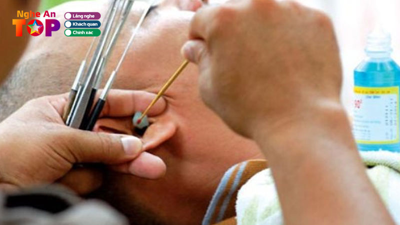 4-dich-vu-lay-ray-tai-o-nghe-an-sach-chuyen-nghiep-khong-dau-ngheantoplist