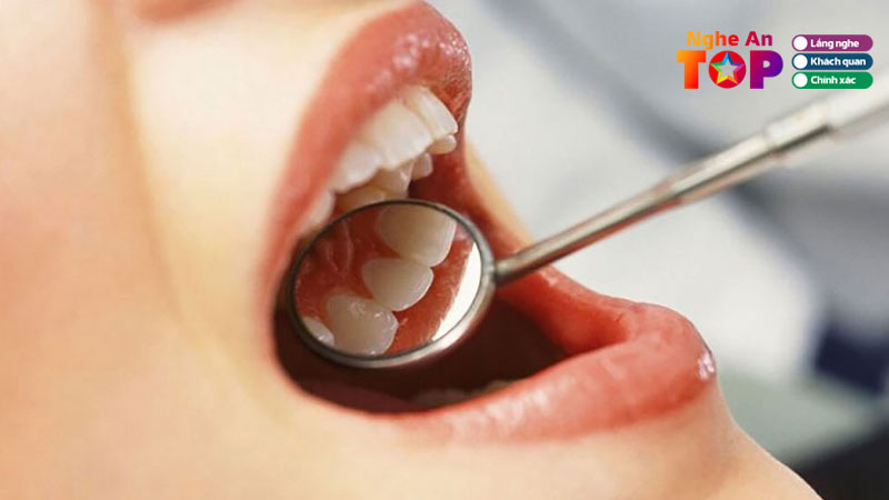 10-nha-khoa-dieu-tri-nha-chu-tai-nghe-an-hieu-qua-khong-tai-phat-ngheantoplist
