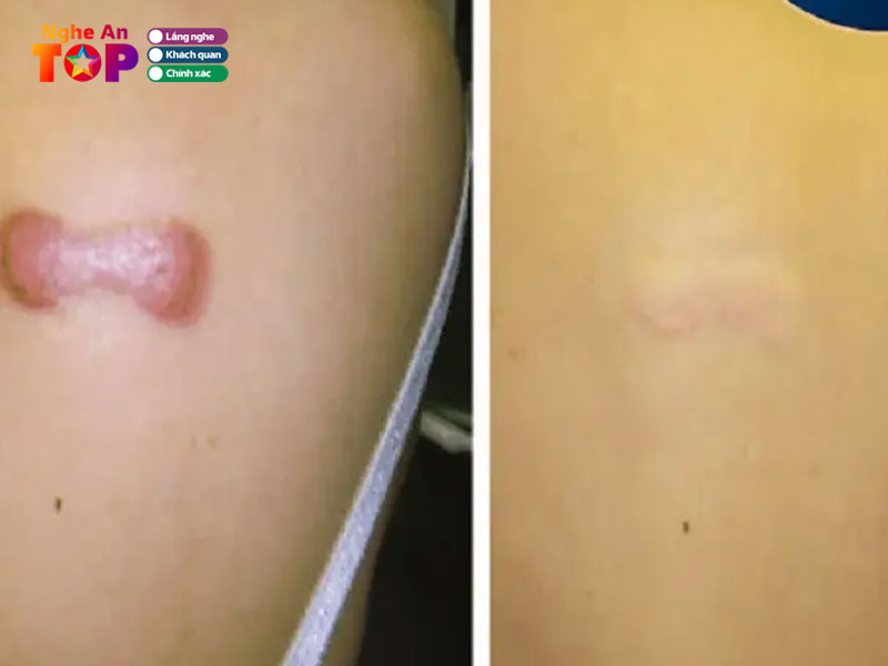 Benh-vien-chan-thuong-chinh-hinh-nghe-an-ngheantoplist