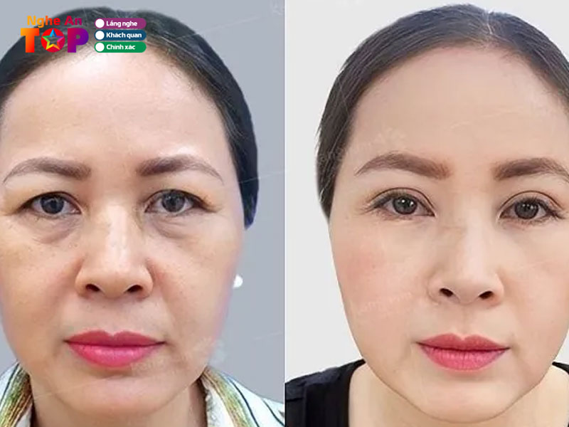 Benh-vien-mat-nghe-an-ngheantoplist