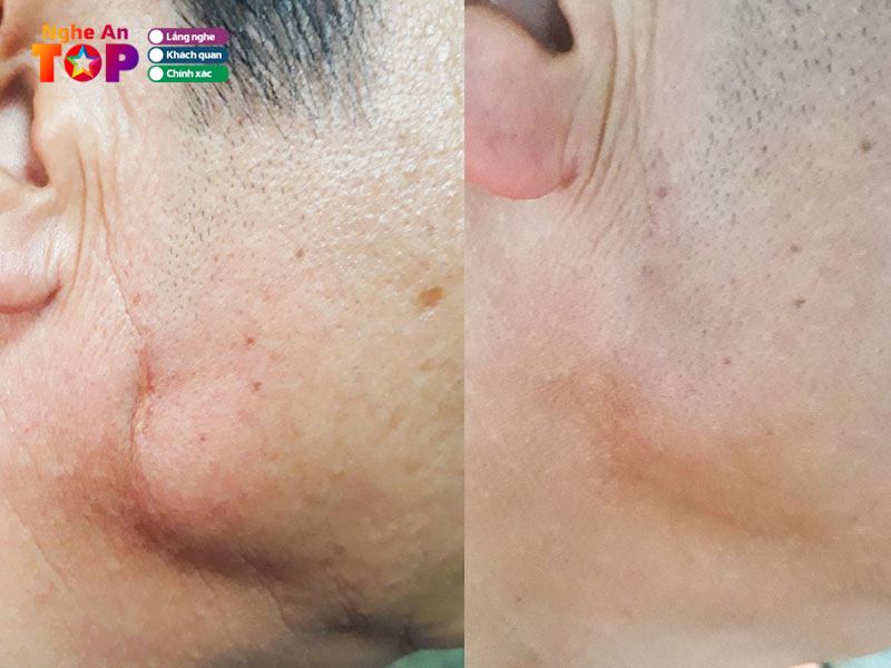 Benh-vien-thai-thuong-hoang1-ngheantoplist