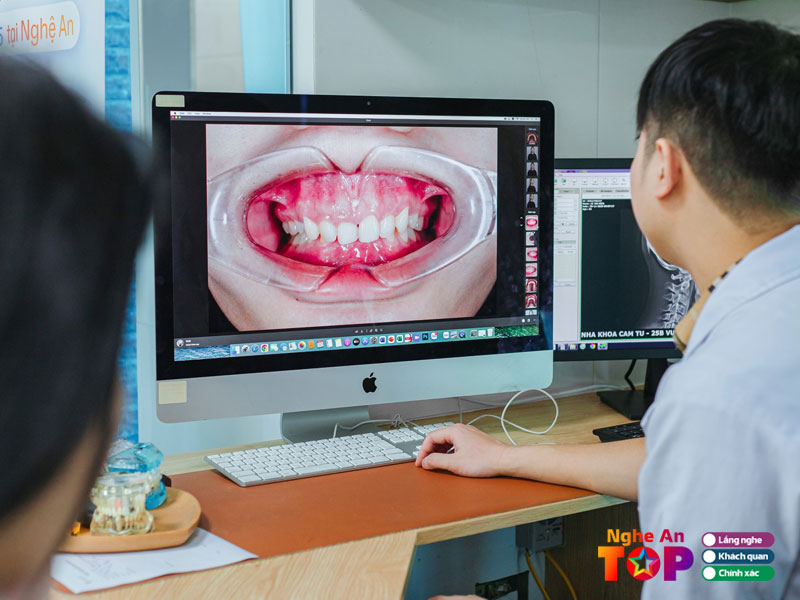 Nha-khoa-cam-tu-ngheantoplist