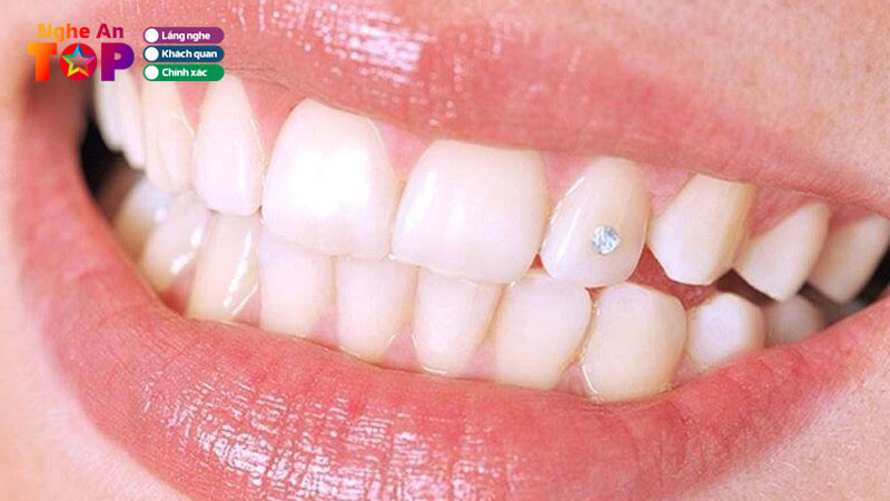 Top-4-dia-chi-dinh-da-tren-rang-tai-nghe-an-dep-an-toan-ngheantoplist