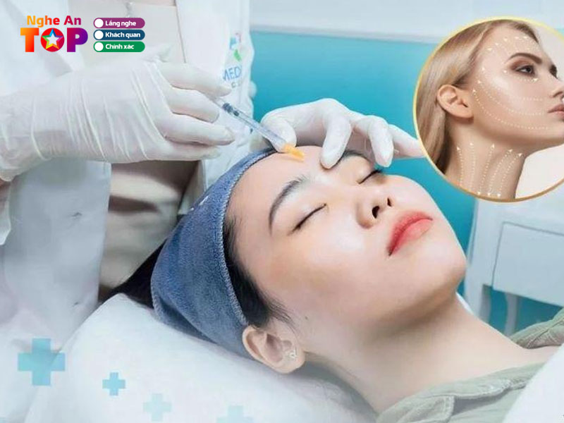 Vien-tham-my-diva-ngheantoplist