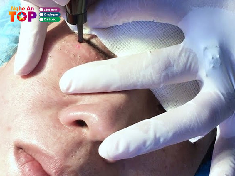 Vien-tham-my-kangnam-ngheantoplist