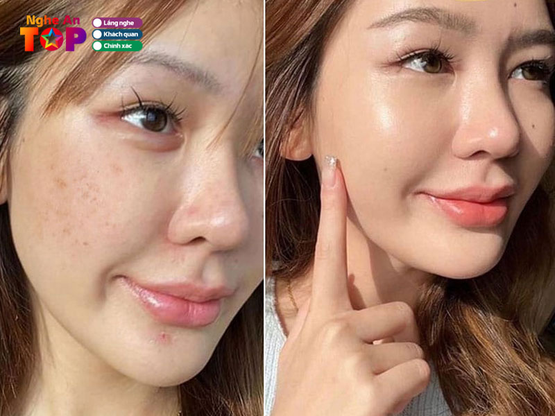 Vien-tham-my-kangnam-ngheantoplist