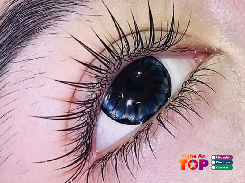 Linh-lash-ngheantoplist