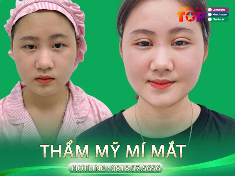 Tham-my-benh-vien-chan-thuong-chinh-hinh-ngheantoplist