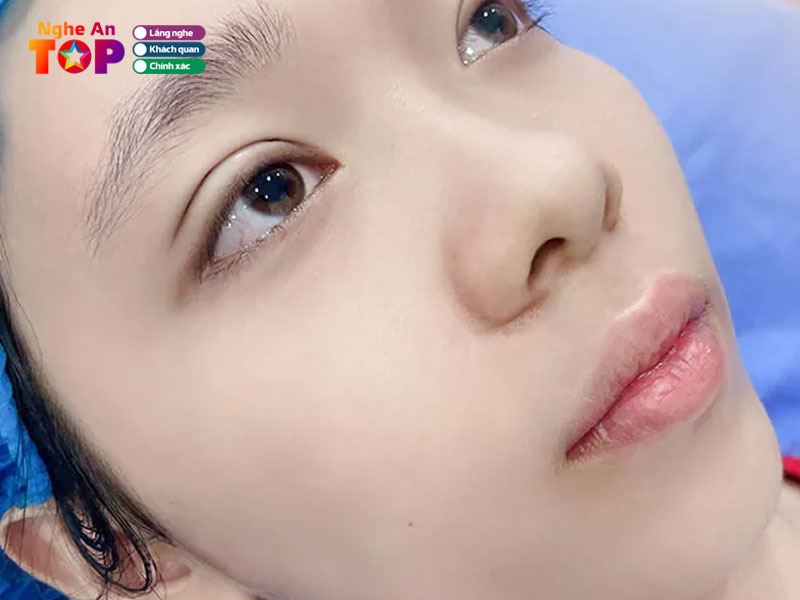Vien-tham-my-kangnam-ngheantoplist
